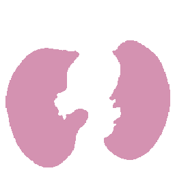 Lung and nodule mask overlay on LAND generated CT sample 1.