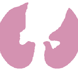 Lung and nodule mask overlay on LAND generated CT sample 2.