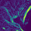Lung CT absolute error, axial slice 33