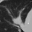 Animated MUMINS lung CT prediction
