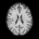 MUMINS predicted brain MRI, axial slice 65
