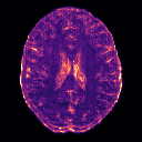 Predicted uncertainty for brain MRI, axial slice 65